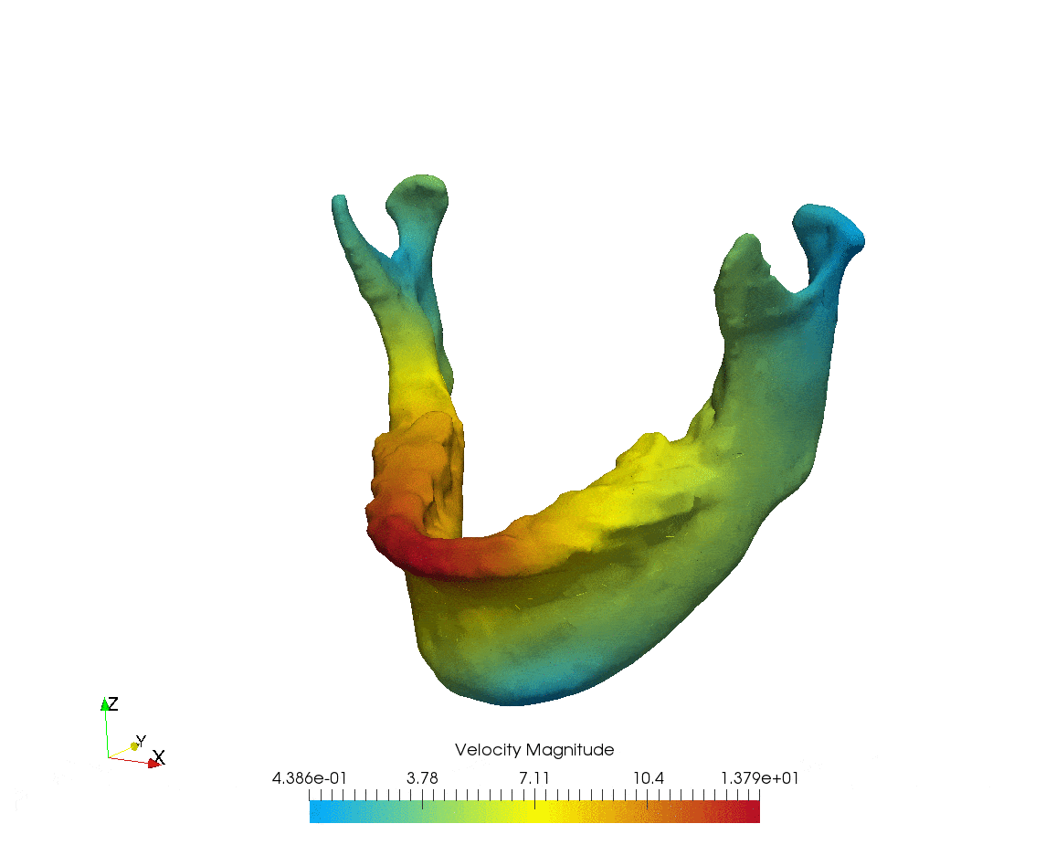 Treatment planning the edentulous mandible Chee & Jivraj
