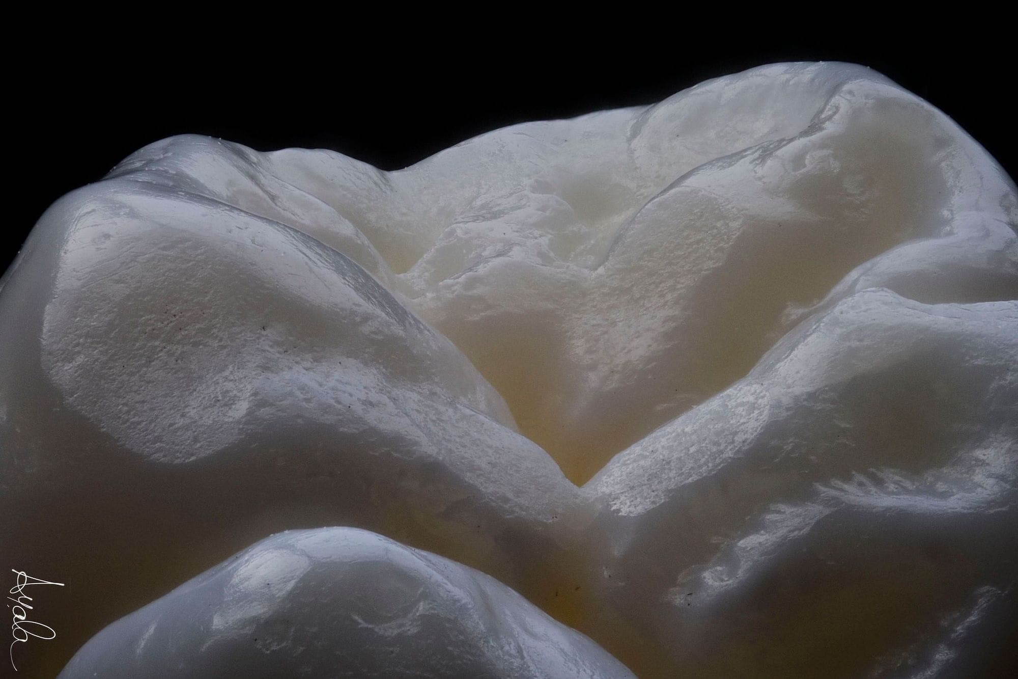 Restorative & Composite Dental Courses The Restorative Programme