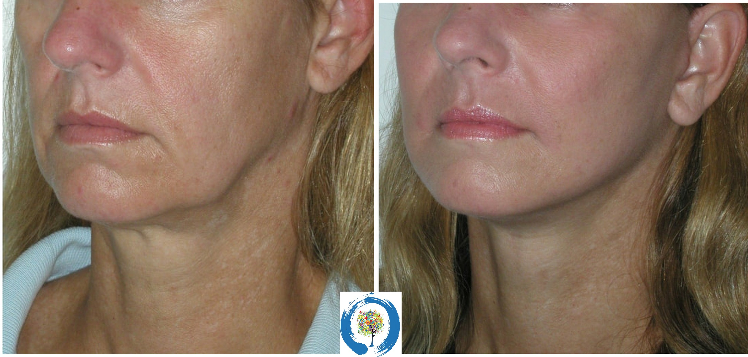 Mint pdo threads coastalvvti