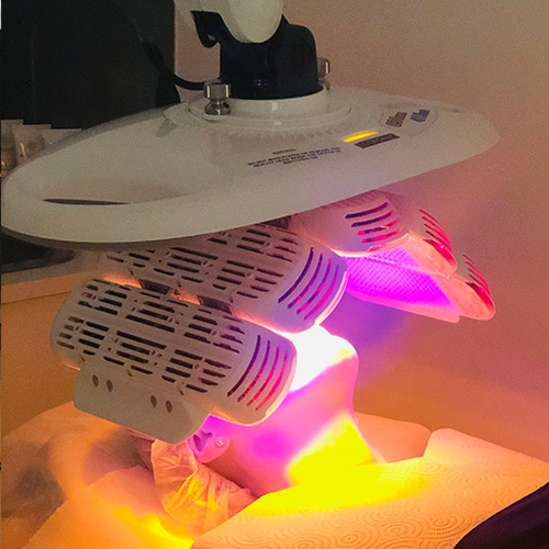 How Much Does It Cost for Microdermabrasion?