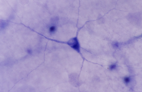 Ganglion cells Retinal Microscopy