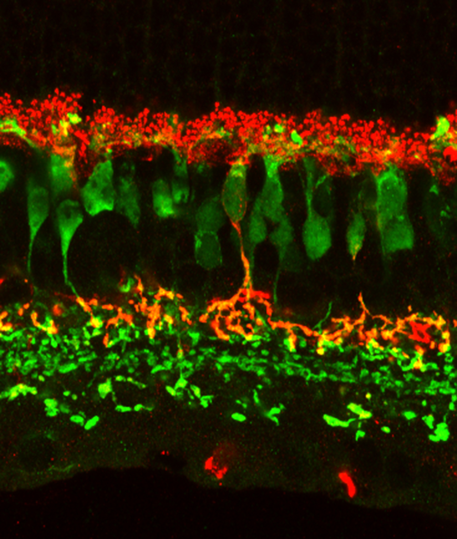 Bipolar cells Retinal Microscopy
