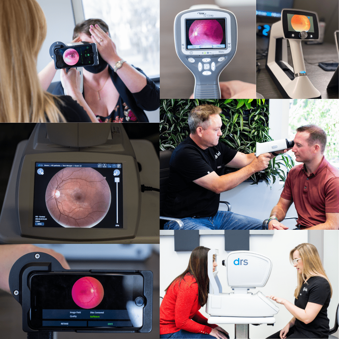 Choosing the Best Retinal Camera for Your Practice IRIS