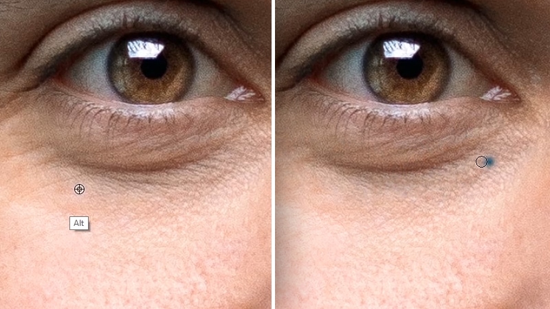 The Best Way To Remove Eye Bags in