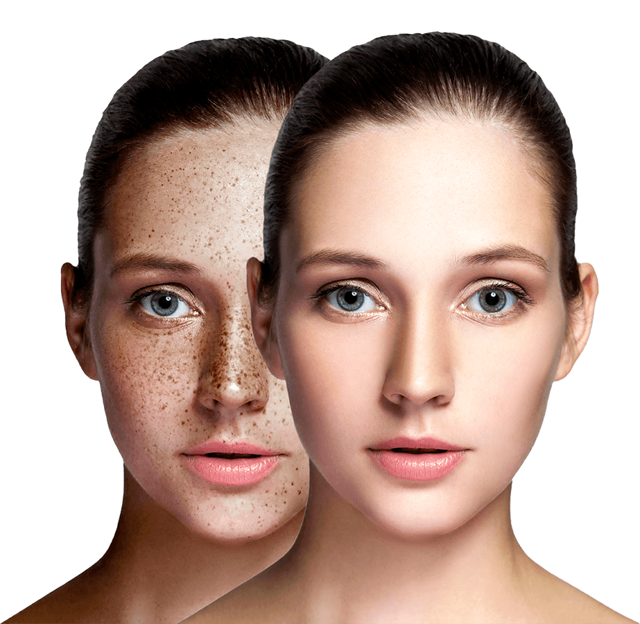 E light IPL and Diode laser therapy REVERSE Laser & Aesthetic Therapy