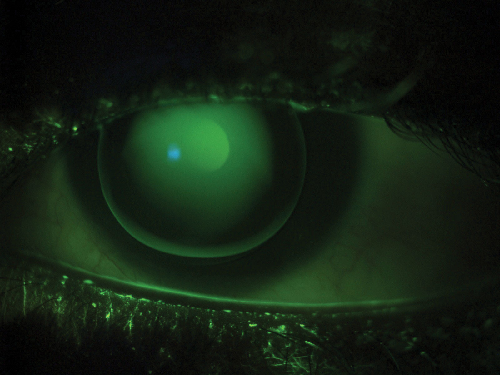 Provide Specialty Contact Lenses and Thrive