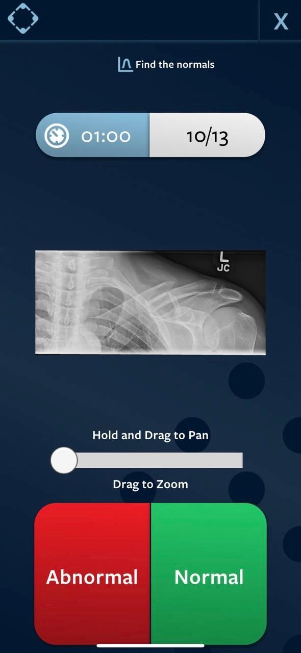 Launched Find the Normals A Revise Radiology Game