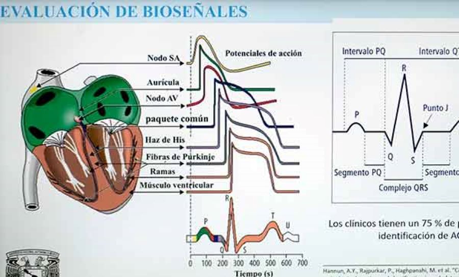 Latidos irregulares en el corazón, principal causa de muerte en el mundo