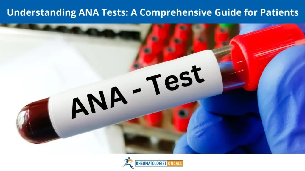 Positive ANA Know Common 5 causes for a positive ANA Test