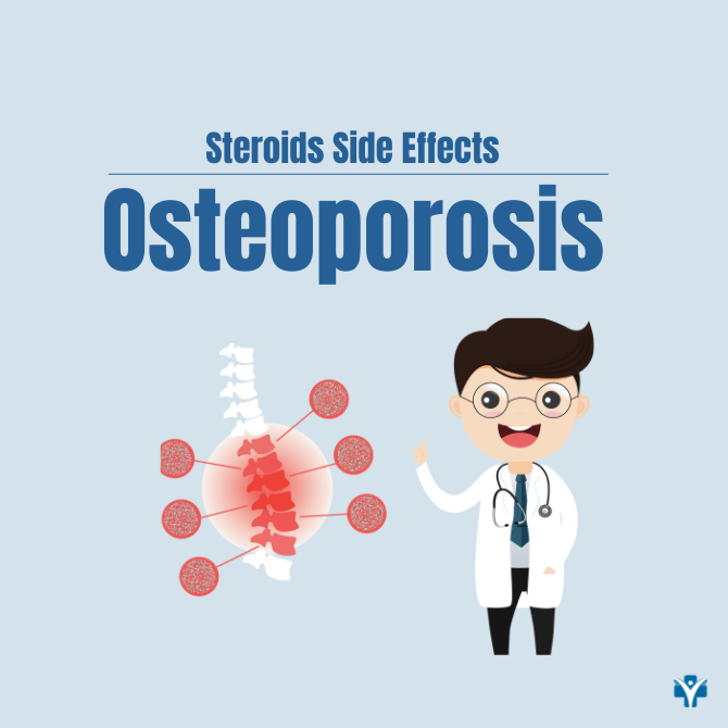 10 Side Effects of Prednisone for Arthritis Patients