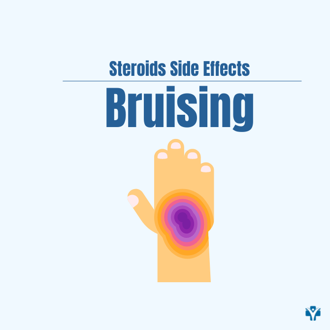 10 Side Effects of Prednisone for Arthritis Patients