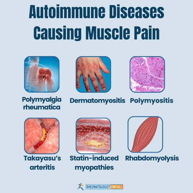 Muscle Pain in Autoimmune Diseases Rheumatologist OnCall