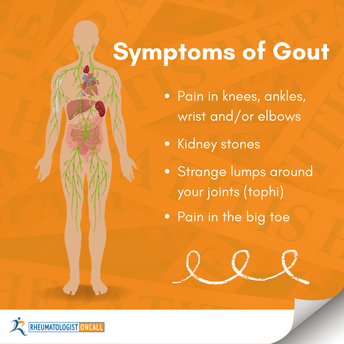 5 Warning Signs & Symptoms Of Gout InDepth Examination