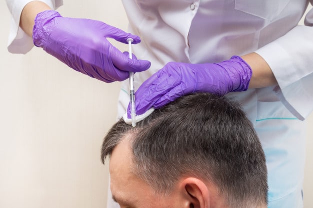 KEEPS review Pro's & Con's of this hair loss treatment fitter