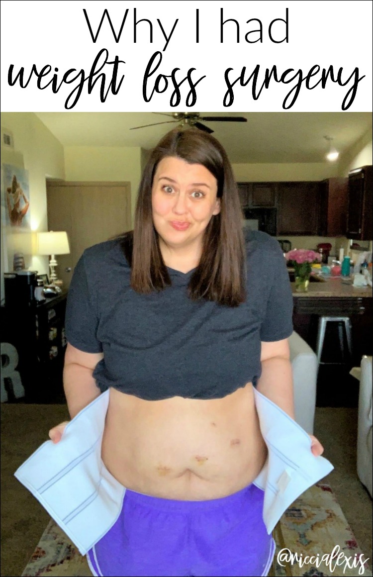 Why I had Weight Loss Surgery