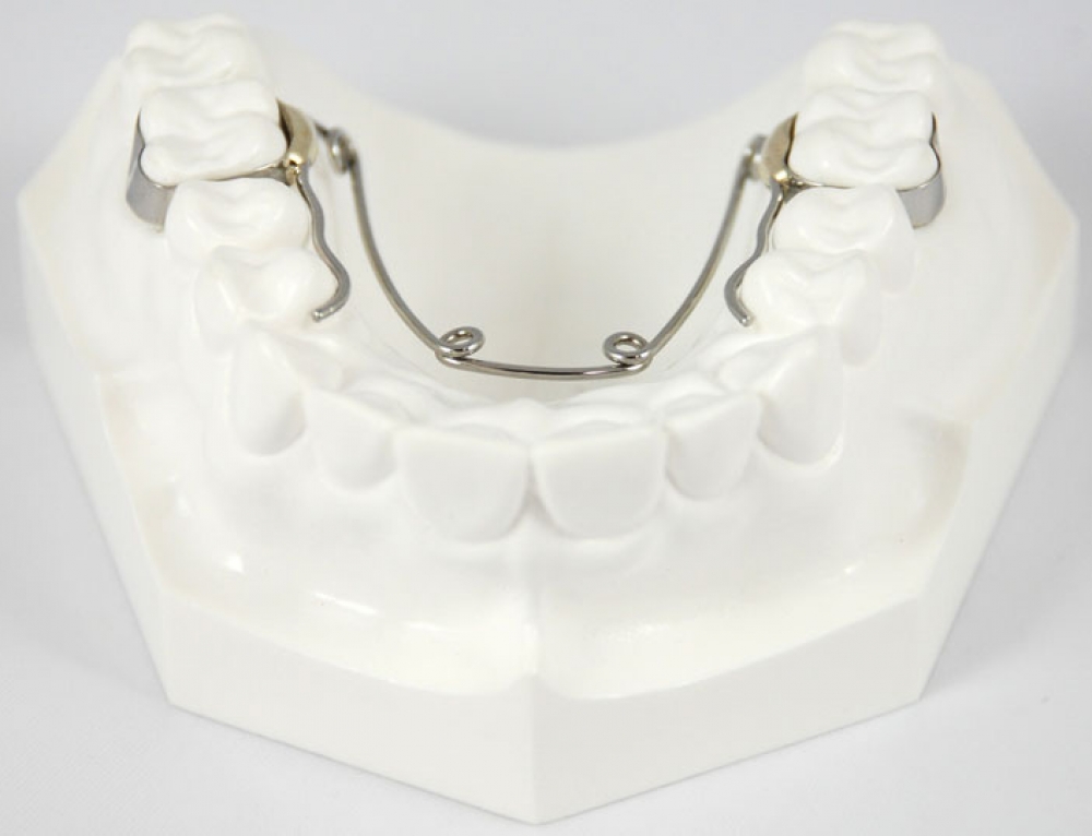 Hyrax Expander 판교 치아교정