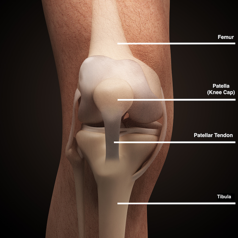 Test, treat and manage Jumper's Knee Riixo Recovery