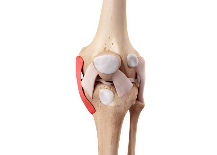 Medial Collateral ligament (MCL) Reconstruction | Repair | Orthopedic