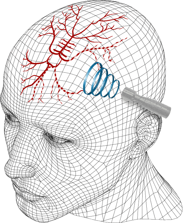 Transcranial Doppler Ultrasound Device (TCD Machine) Rimed Ltd