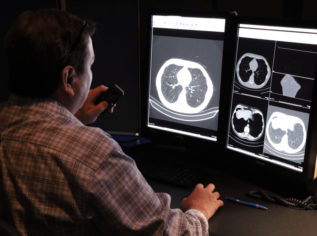Lung Cancer Screening Rhode Island Medical Imaging
