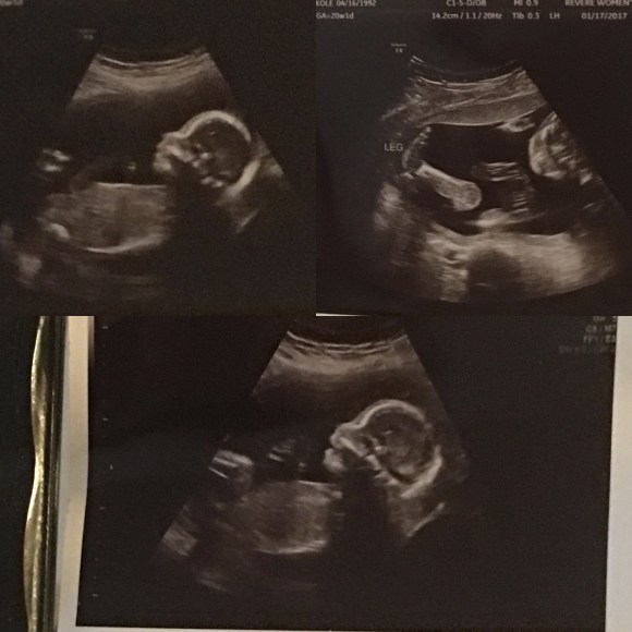 20 Week Ultrasound The Rios Family Blog