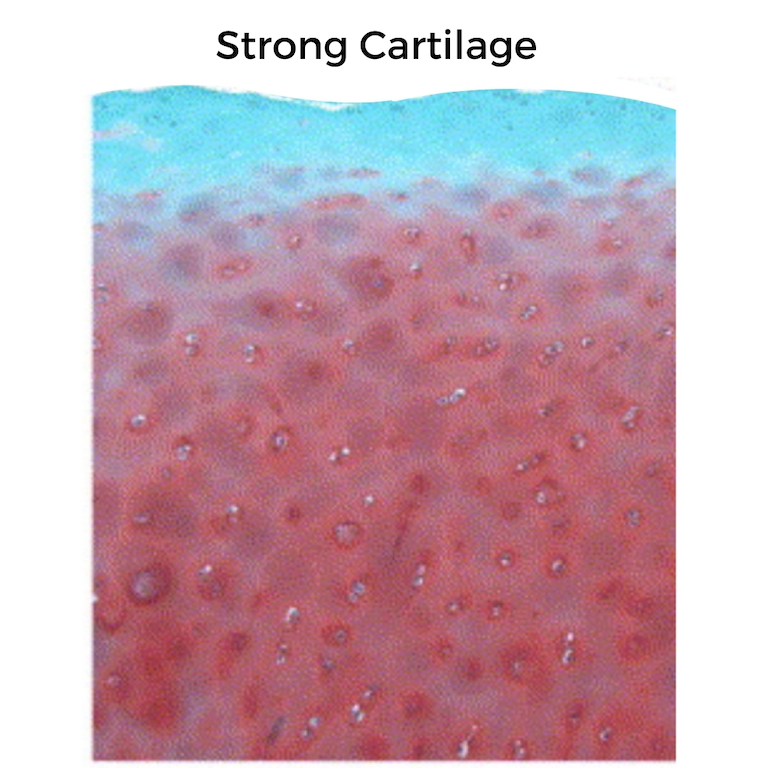 Can you rebuild knee cartilage? Rita Chorba, PT