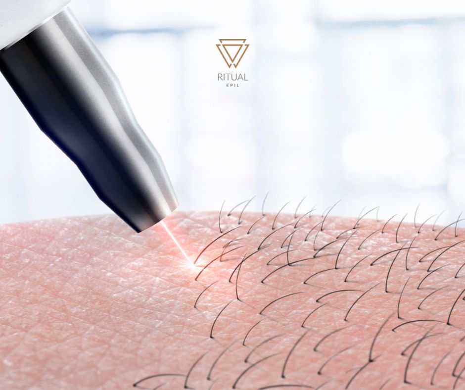 back Ritual Epil N1 de l’épilation définitive lowcost