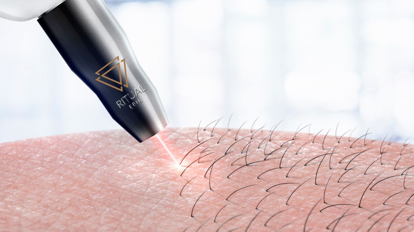 background Ritual Epil N1 de l’épilation définitive lowcost
