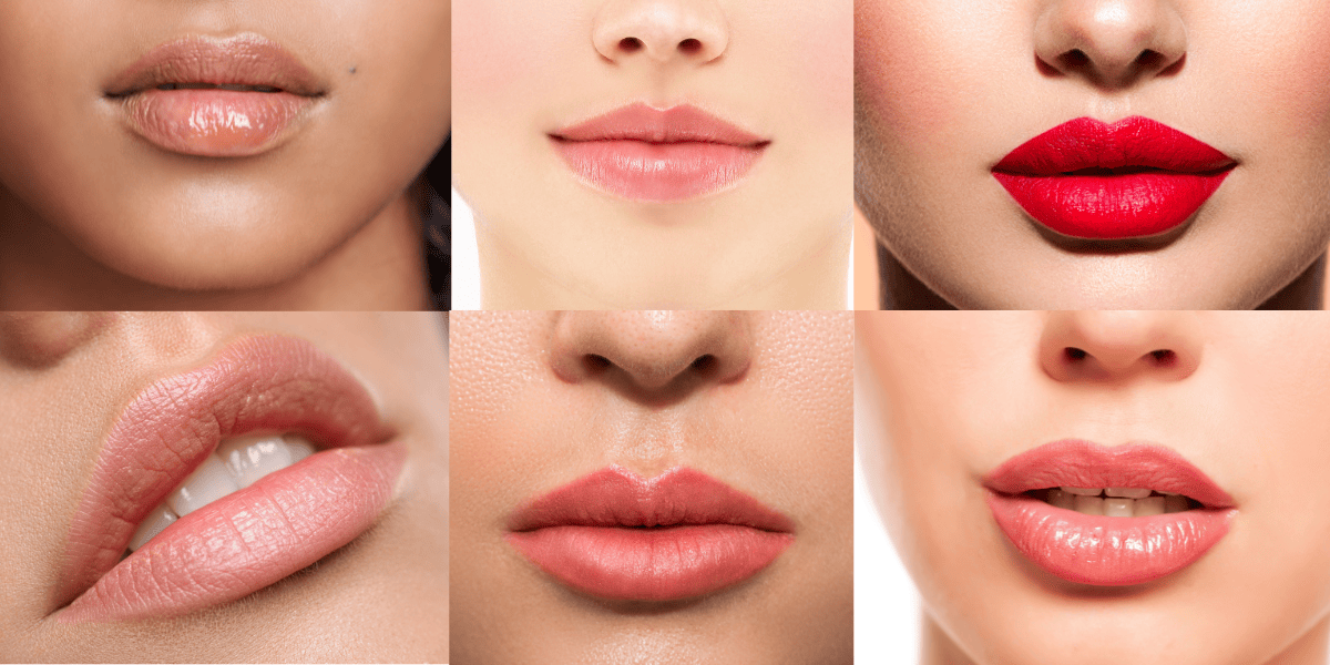 Natural Looking Lips Lip Filler River Aesthetics