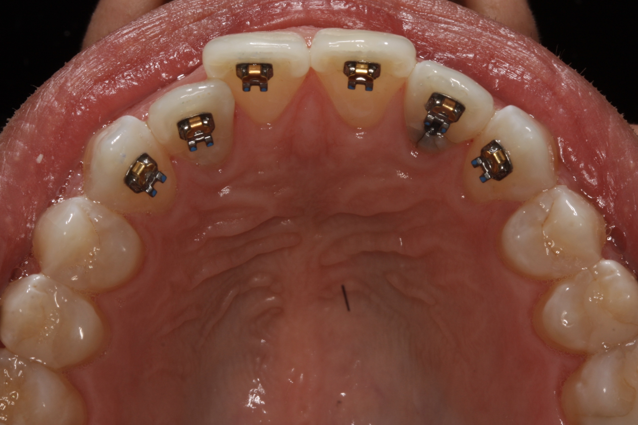 What We Can Do for You Riviera Orthodontics