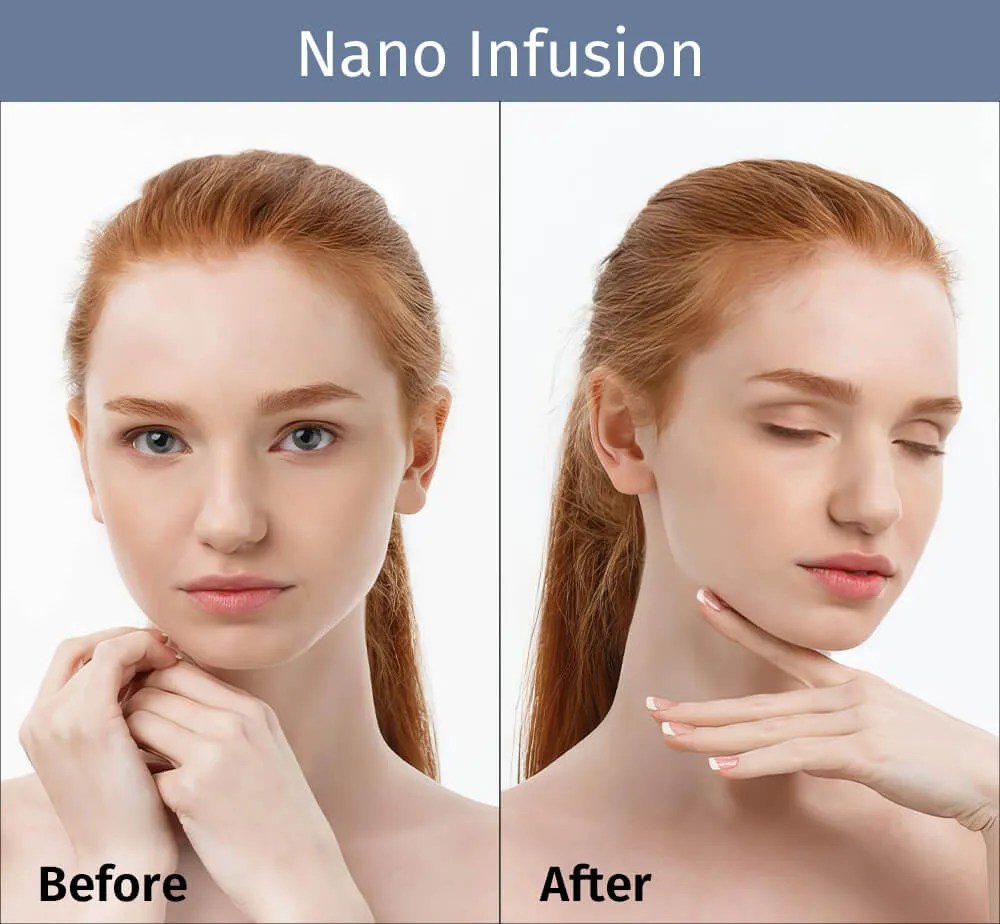Nano Infusion Skincare with Advanced Technology