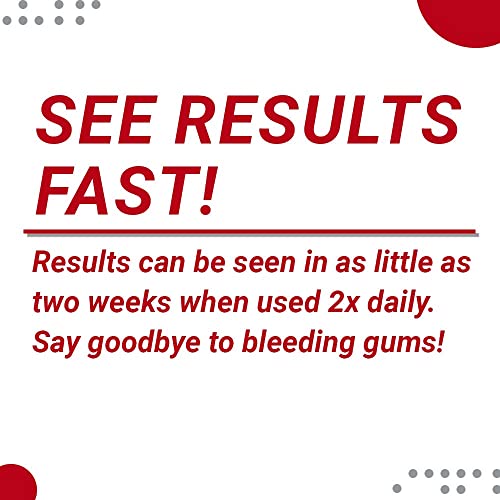 PerioCare Gel for Trays (5 Tubes + Trays) 1.7 Hydrogen Peroxide Gel