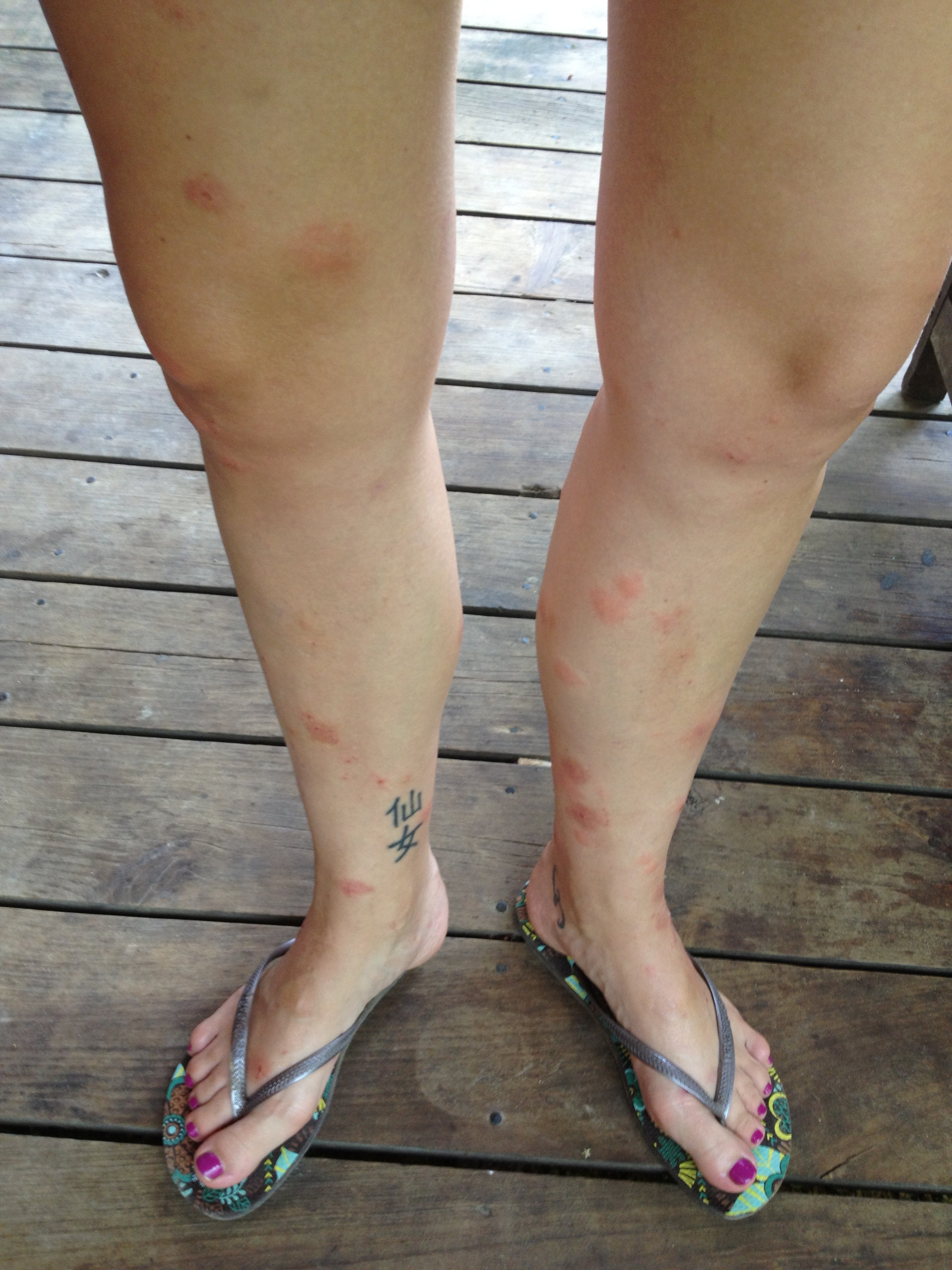 What to Do About the )^&* Sandflies! We LOVE Roatan Blog!!