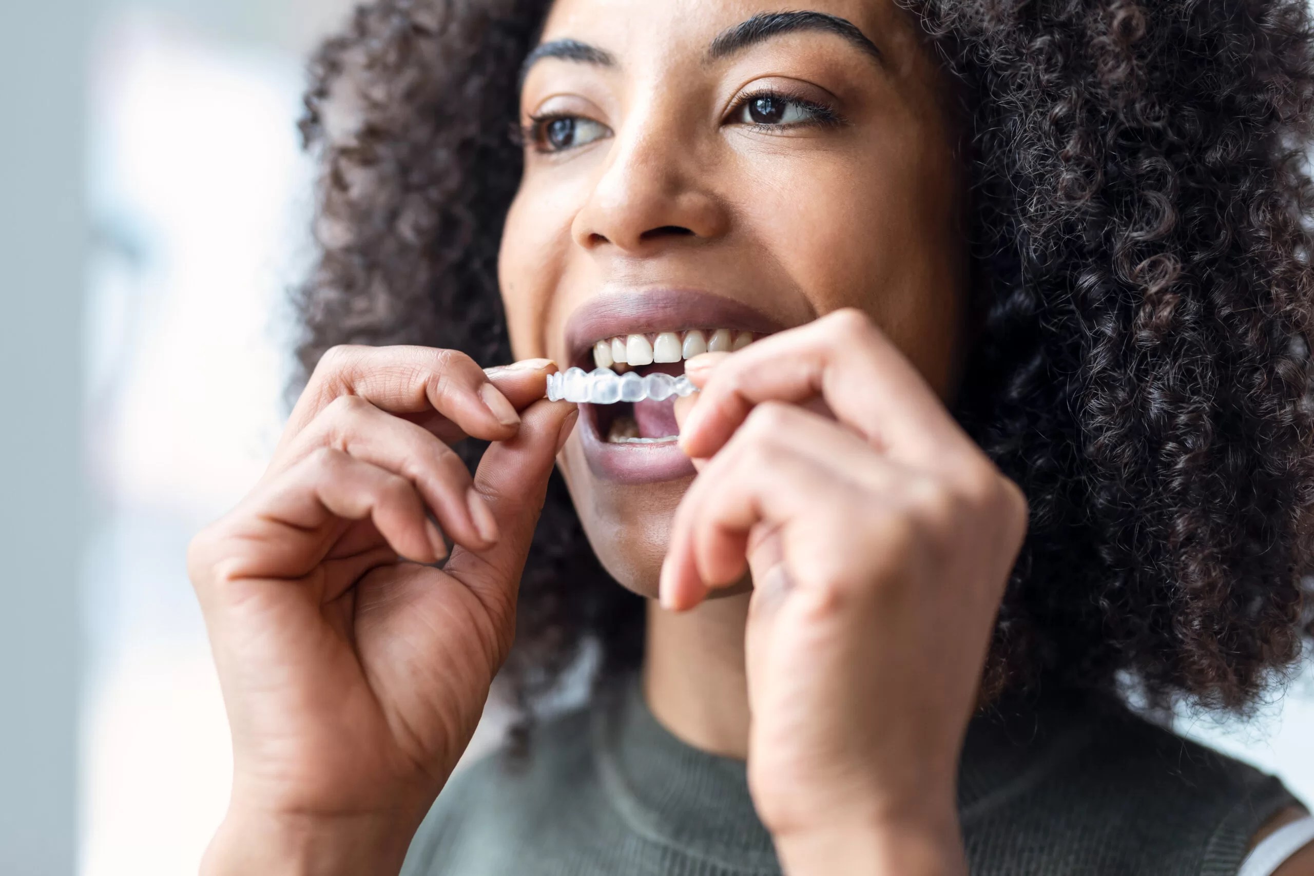 Top Three Reasons To Use Clear Aligners