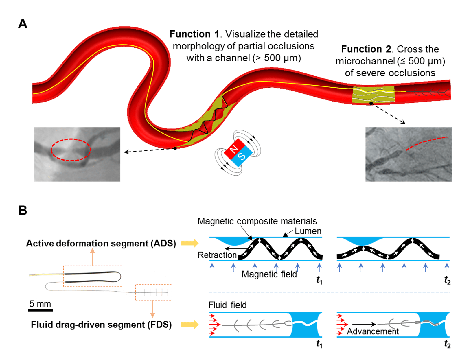 Smooth robotic device gives new ‘eyes’ in endovascular surgical