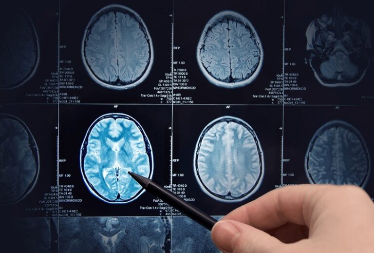 Deep Learning in Medical Image Processing Scope and challenges