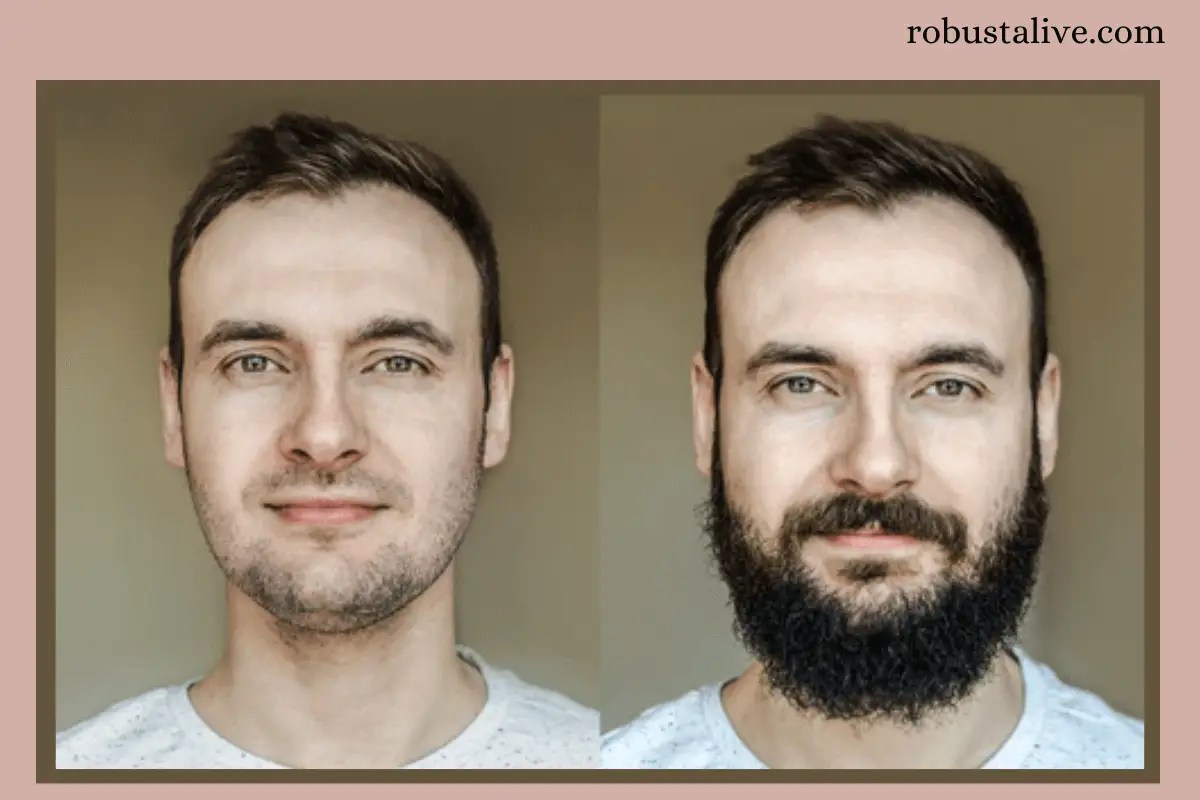 Will testosterone help grow a beard? Robustalive
