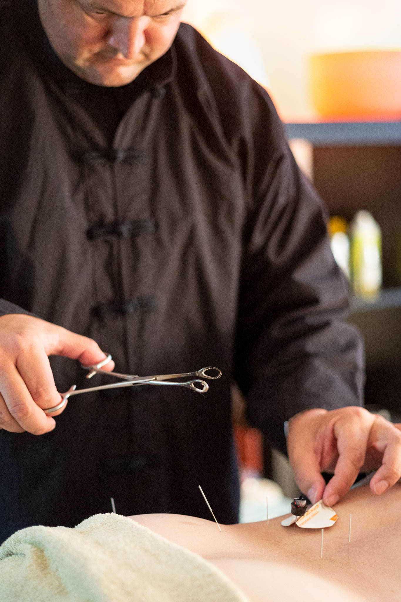 Acupuncture Acupuncture Sydney, Chinese herbal medicine Sydney