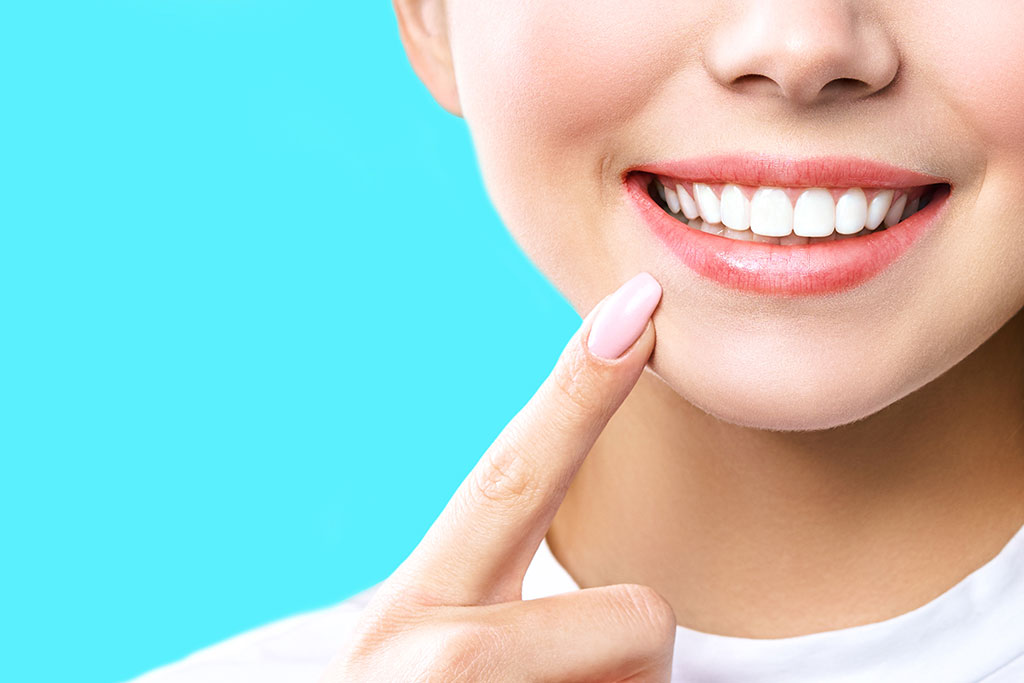 Clareamento Dental Quais tipos existem e como funcionam? Invisalign