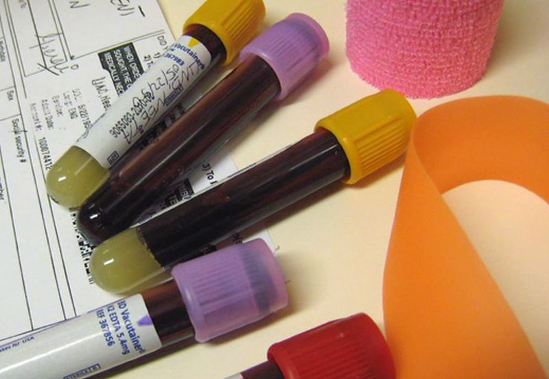 blood_vials Roidvisor Your reliable guide in Steroids