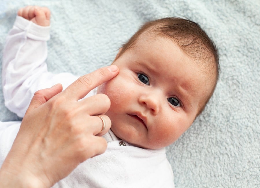 Eczema Treatment options, what’s best for your child’s skin type