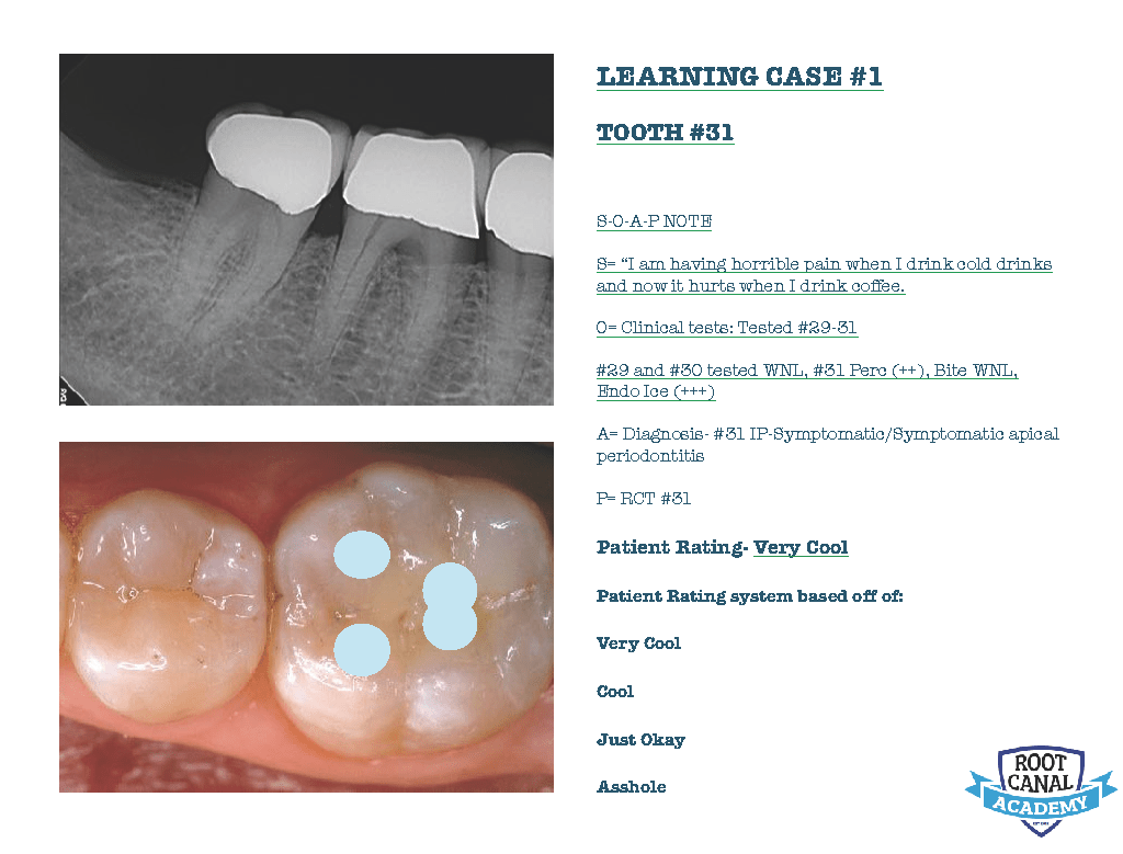 Learning Lessons 1 Root Canal Technique Root Canal Academy