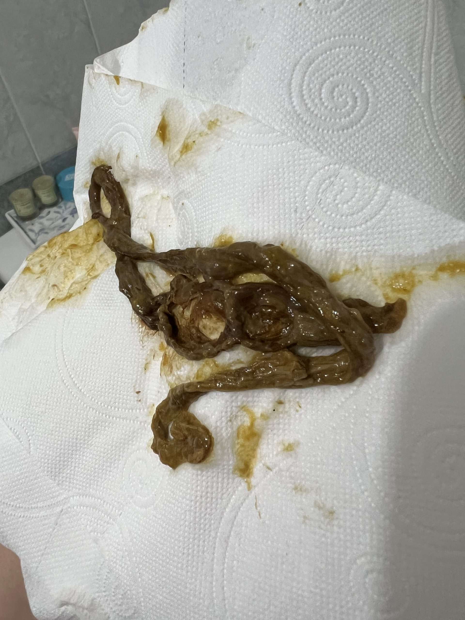 What Does the Rope Worm Look Like Rope Worms What are They?