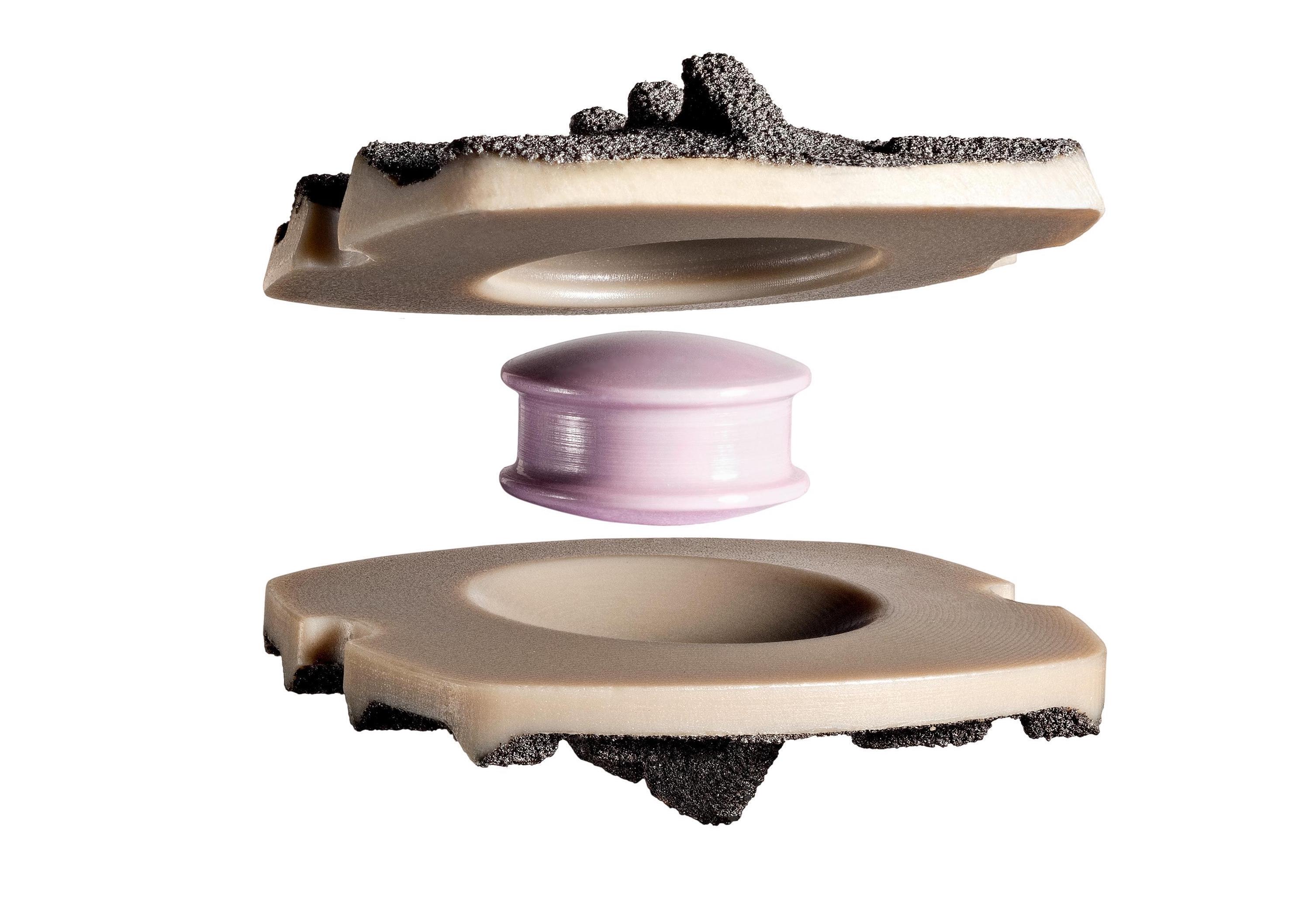 Artificial Disc Rory Mayer, MD