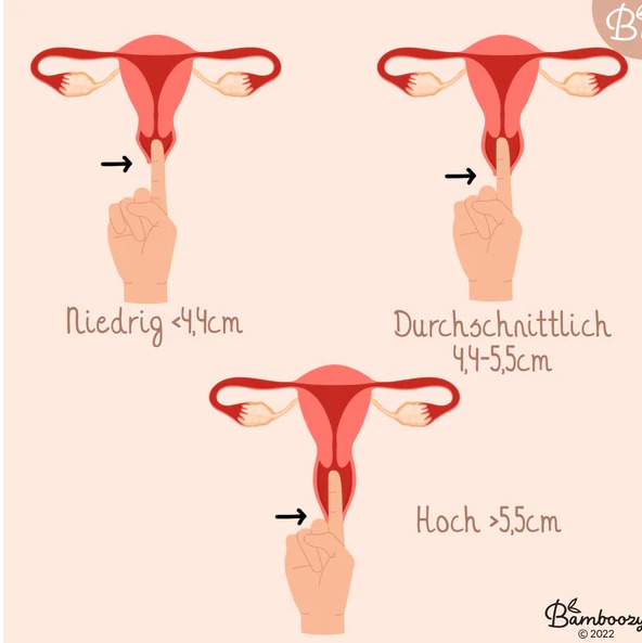 Menstruations-Scheibe - Rotmarie