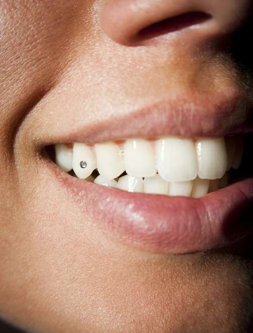 Tooth Gems ROYAL BROWS