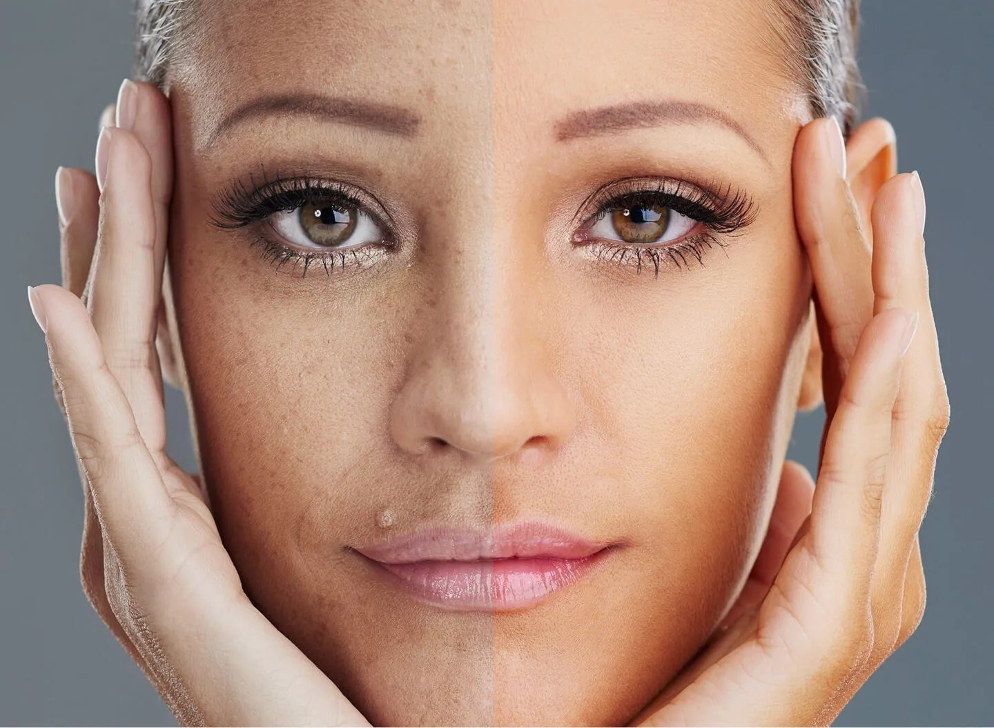 Red Face That Won’t Go Away? How to Spot Rosacea & Treat It Effectively