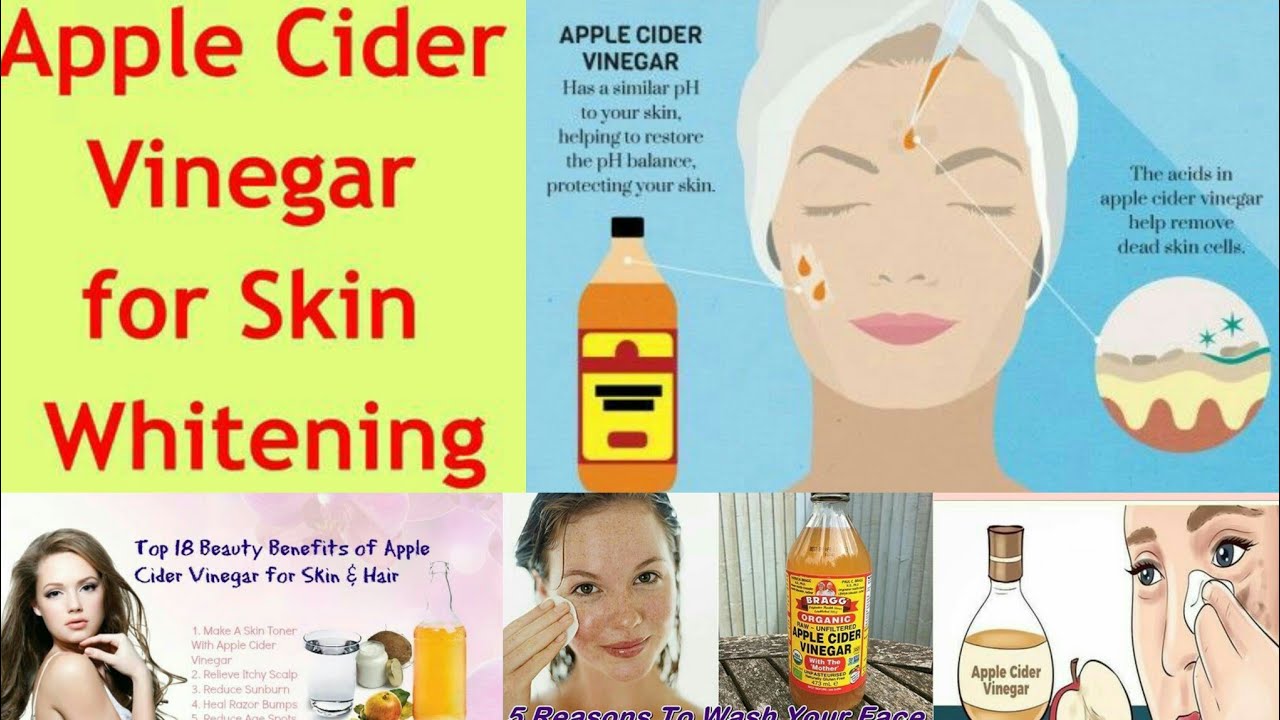 Apple cider vinegar for razor bumps/burns/remedies and treatments