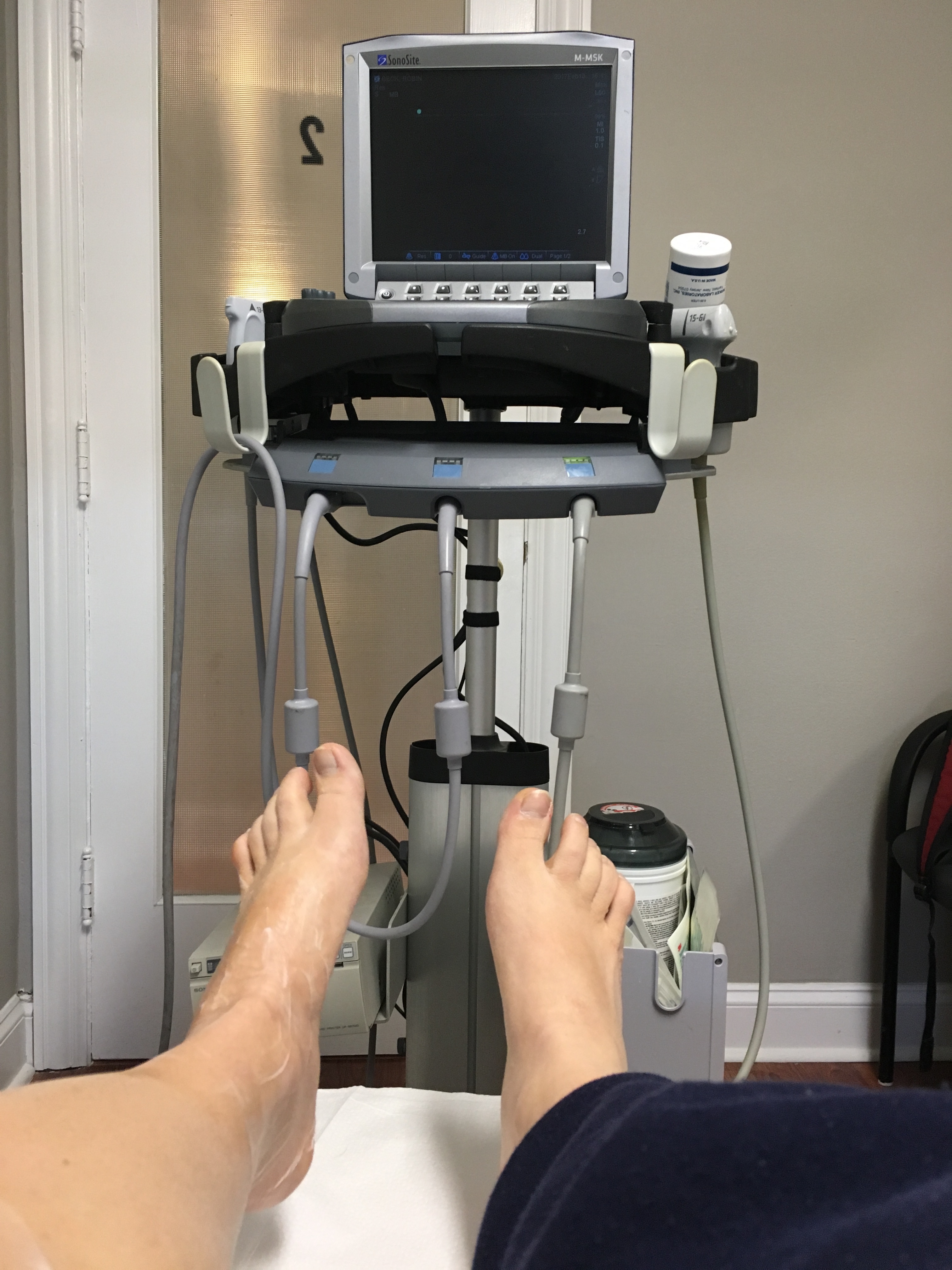 prolotherapy treatment Runnin’ and Roamin’