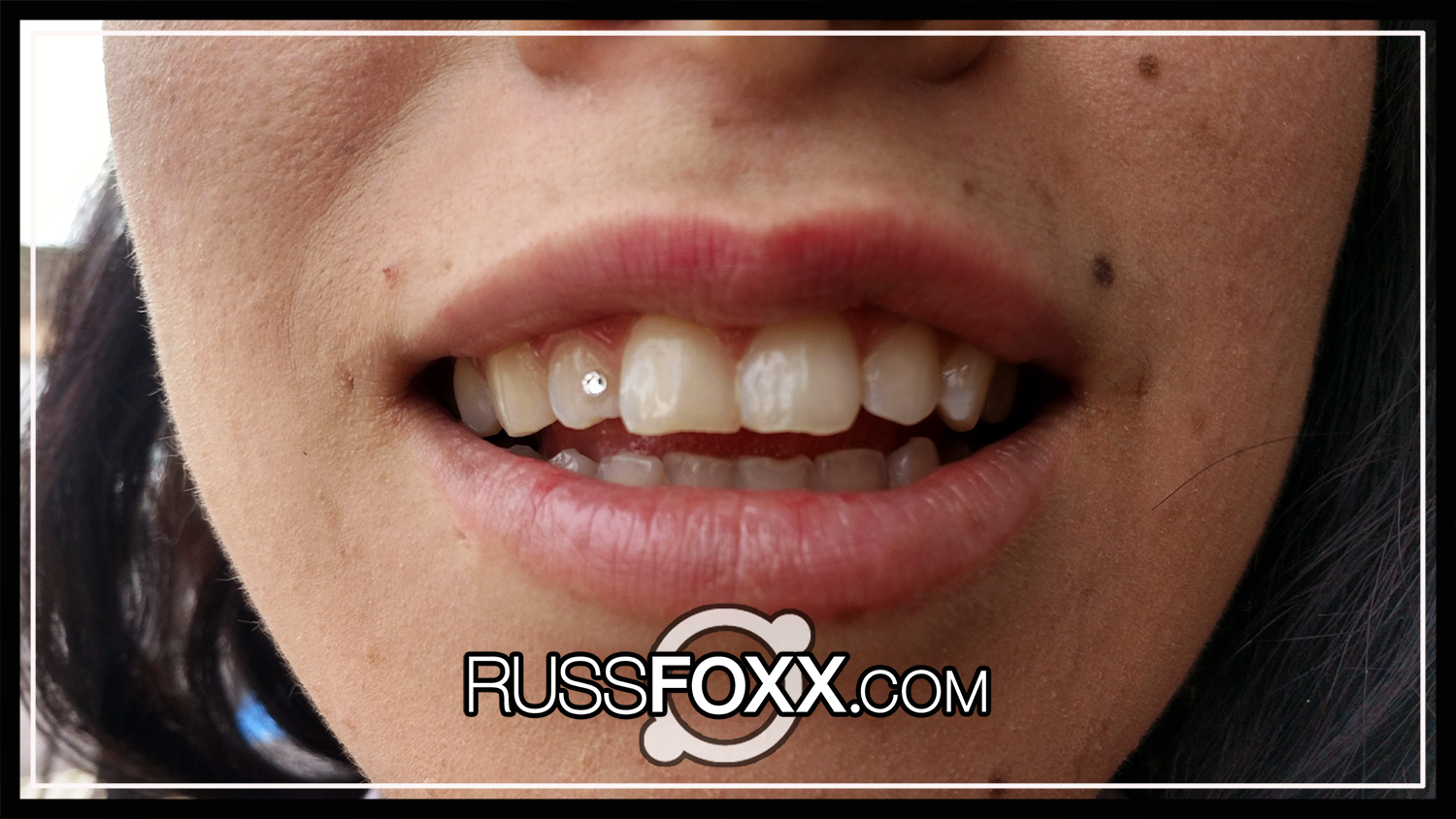 Tooth Gems Russ Foxx